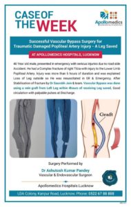 Successful Vascular Bypass Surgeon in Lucknow