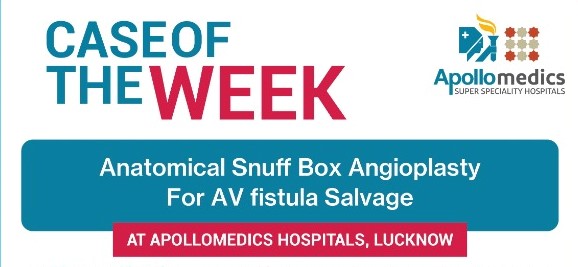Case Of Anatomical Snuff Box Angioplasty