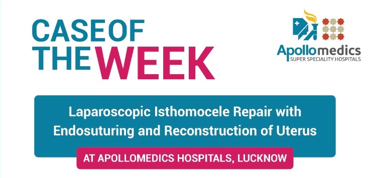 Case Of the Laparoscopic Isthomocele Repair