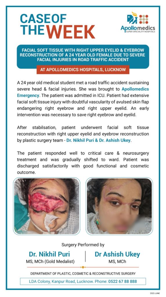 Facial Soft Tissue Resonstruction in Lucknow